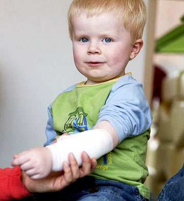 Foto: Ein kleiner Junge mit bandagiertem Arm.